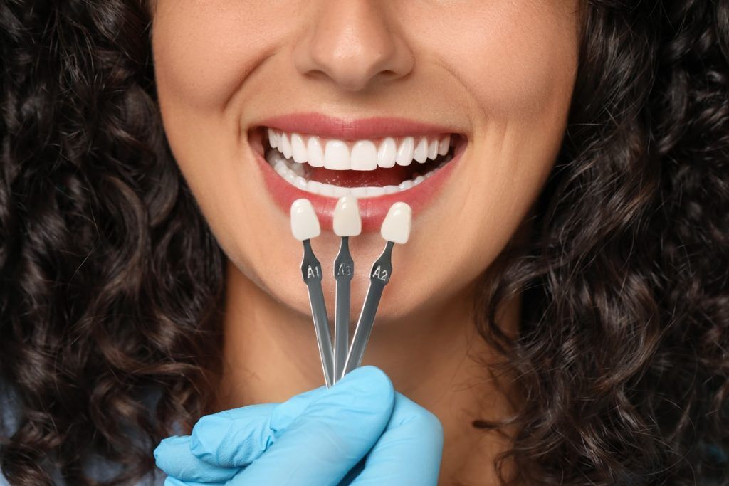 Porcelain vs Composite Veneers: Which Option Is Better in Oakville?